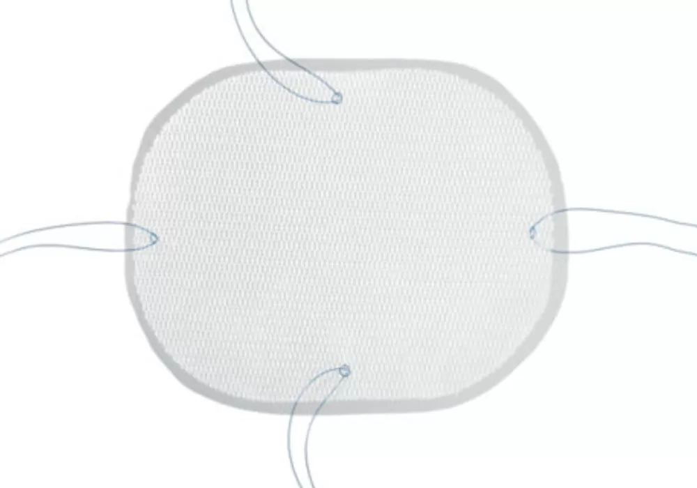 Covidien Parietex Optimized Composite Mesh Polyester With Absorbable Collagen Film, 25 cm x 20 cm