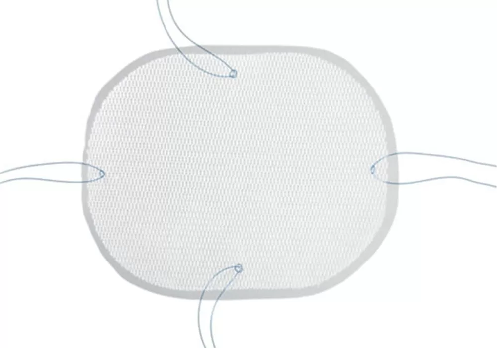 Covidien Parietex Optimized Composite Mesh Polyester With Absorbable Collagen Film, 30 cm x 20 cm