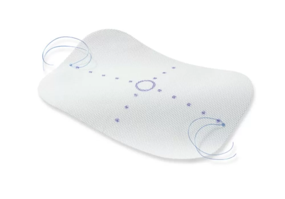 Covidien Parietene DS Composite Mesh, Monofilament Polypropylene Mesh With Absorbable Synthetic Film And Marking, 20 cm x 15 cm
