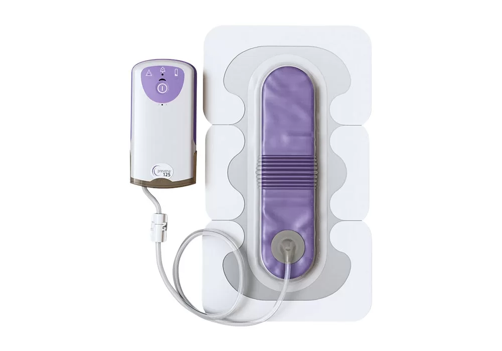 KCI Prevena Incision Management System