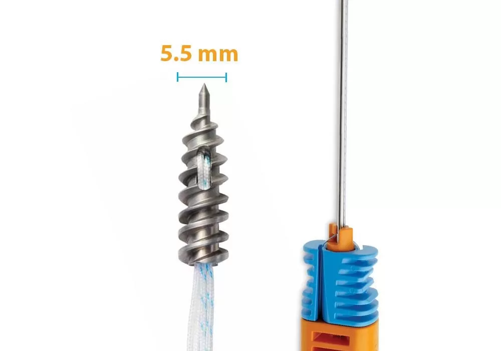 Smith & Nephew 5.5 mm TWINFIX Ultra Ti Anchor w/Three #2(White,COBRAID-Blue,COBRAID-Black)