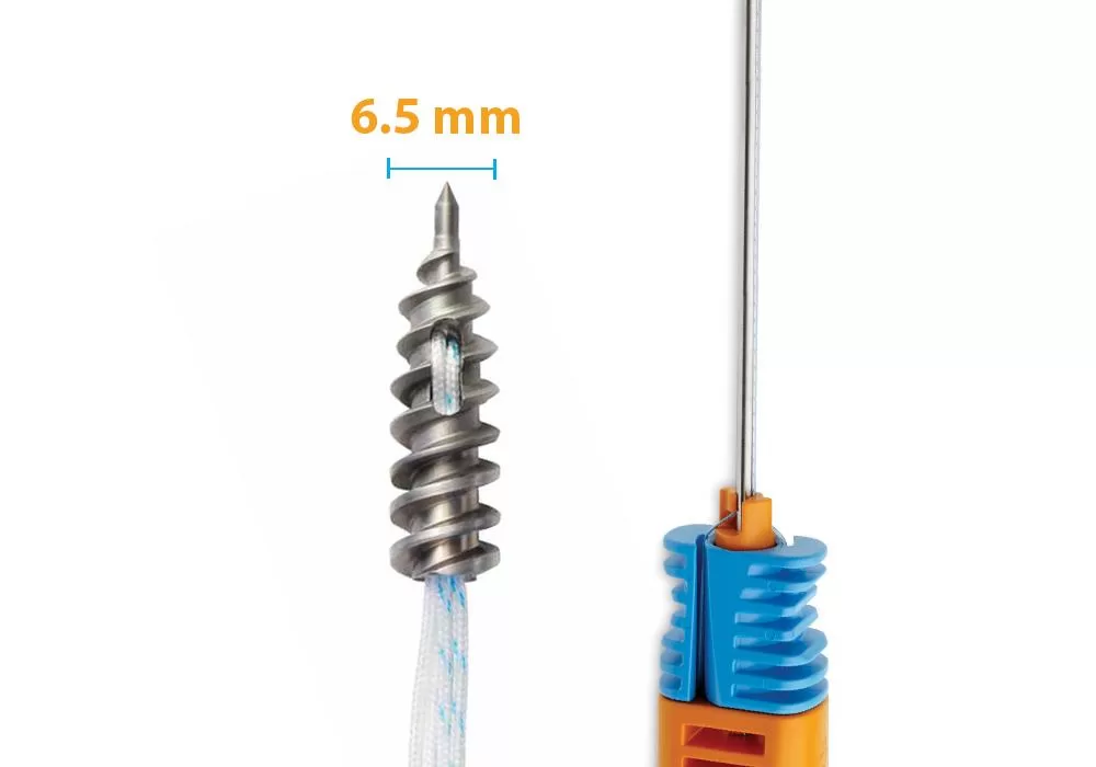 Smith & Nephew 6.5 mm TWINFIX Ultra Ti Anchor w/Three #2(White,COBRAID-Blue,COBRAID-Black)